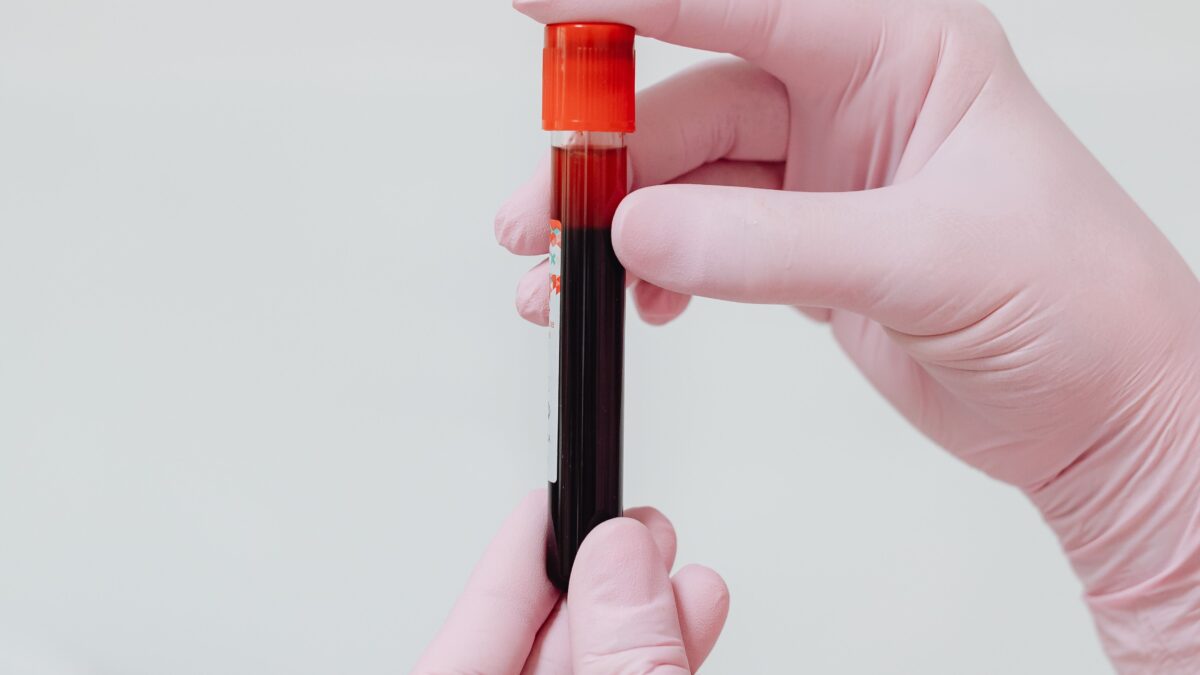 Tutkimus paljasti merkittävän eron AstraZeneca-rokotettujen veren hyytymisajassa